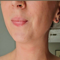 хотмомнекстдор11 Голи