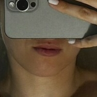 Шипирес Голи