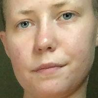 Тейл Мийт Голи